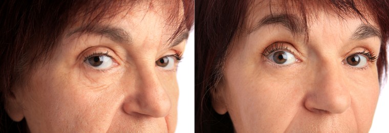 Image of Ageing. Photos of woman's face, closeup. Collage showing difference in skin texture