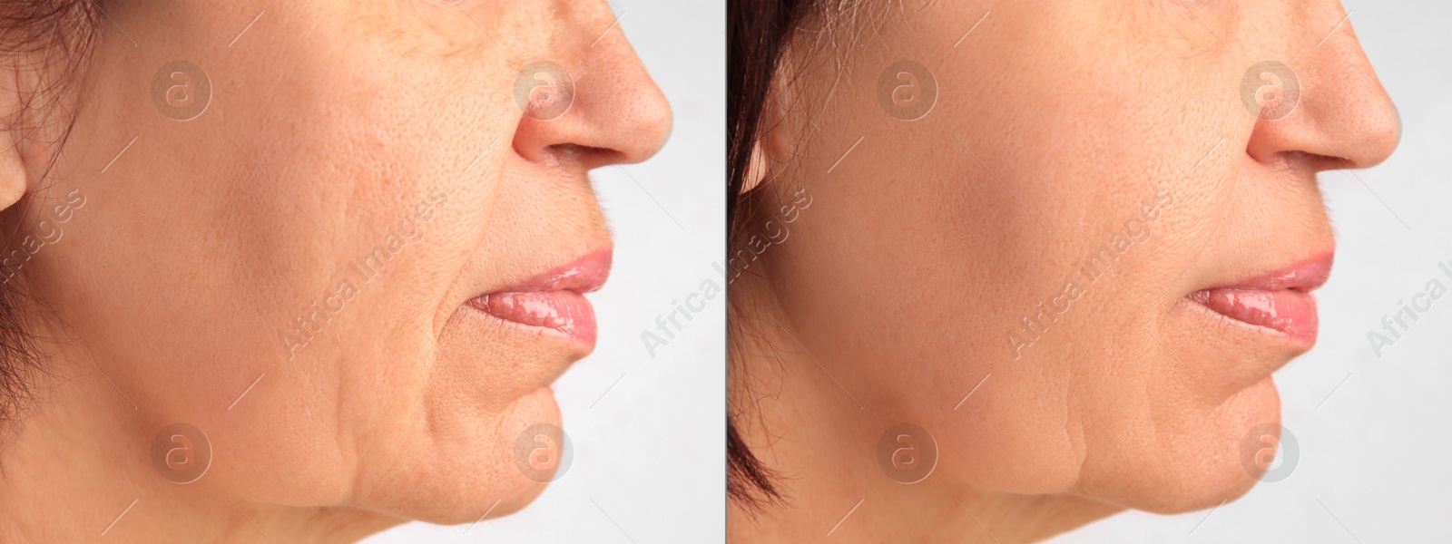 Image of Ageing. Photos of woman's face, closeup of lower part. Collage showing difference in skin texture