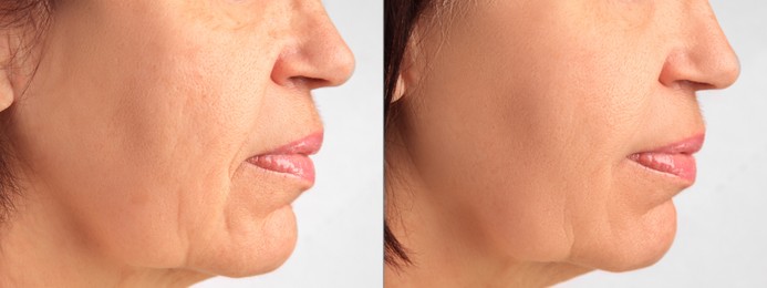 Image of Ageing. Photos of woman's face, closeup of lower part. Collage showing difference in skin texture