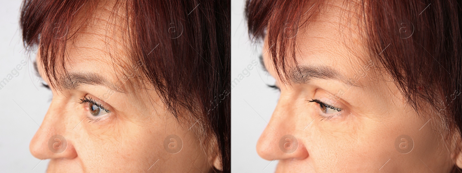 Image of Ageing. Photos of woman's face, closeup. Collage showing difference in skin texture