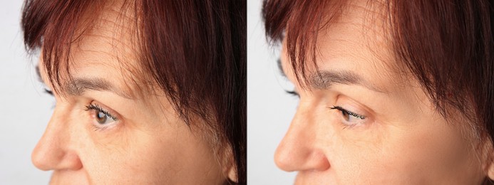 Image of Ageing. Photos of woman's face, closeup. Collage showing difference in skin texture