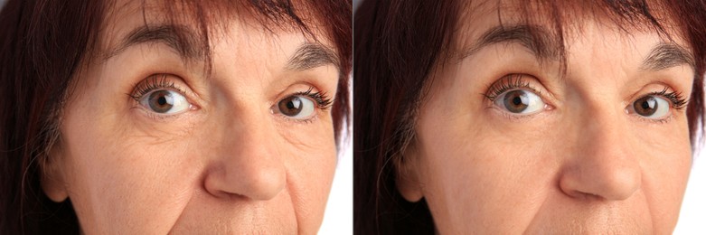 Image of Ageing. Photos of woman's face, closeup. Collage showing difference in skin texture