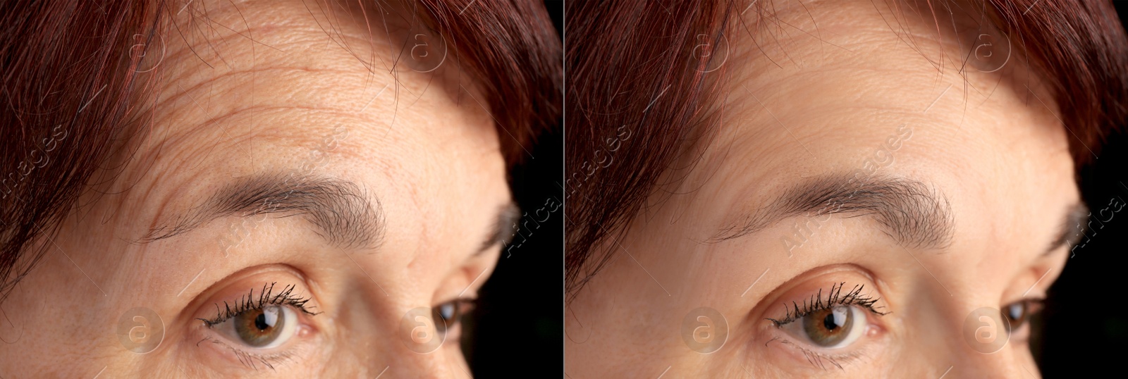 Image of Ageing. Photos of woman's face, closeup. Collage showing difference in skin texture
