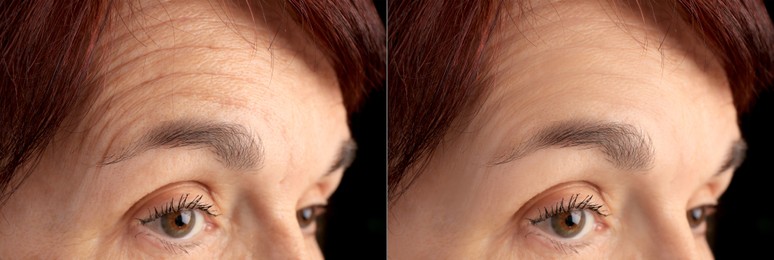 Image of Ageing. Photos of woman's face, closeup. Collage showing difference in skin texture