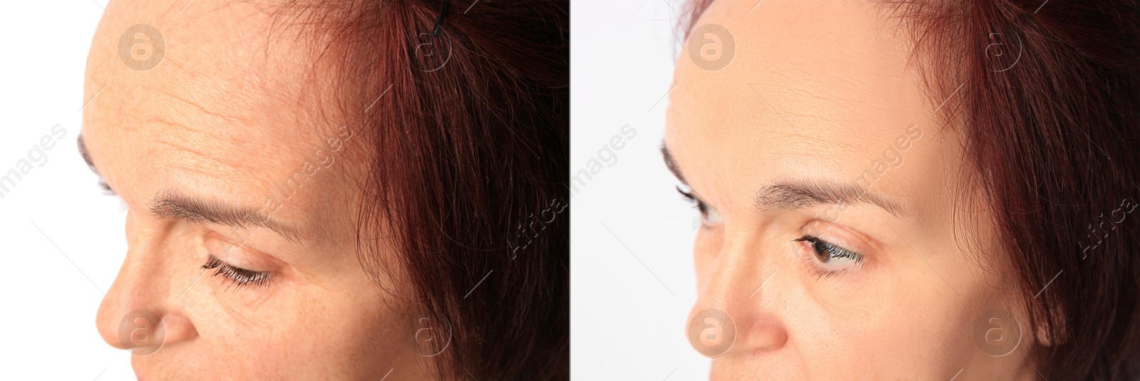 Image of Ageing. Photos of woman's face, closeup. Collage showing difference in skin texture