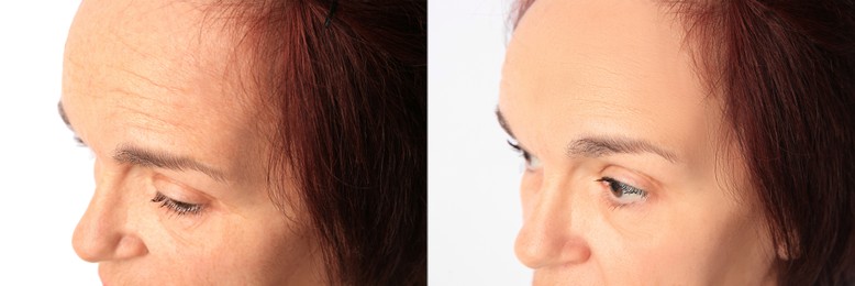 Image of Ageing. Photos of woman's face, closeup. Collage showing difference in skin texture