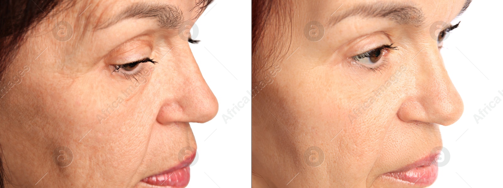 Ageing. Photos of woman's face, closeup. Collage showing difference in skin texture Image of Ageing. Photos of woman's face, closeup. Collage showing difference in skin texture