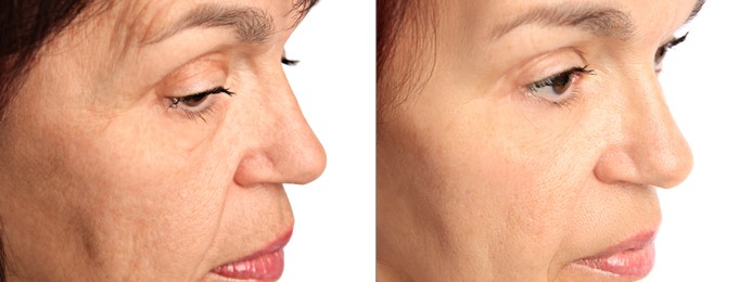 Image of Ageing. Photos of woman's face, closeup. Collage showing difference in skin texture