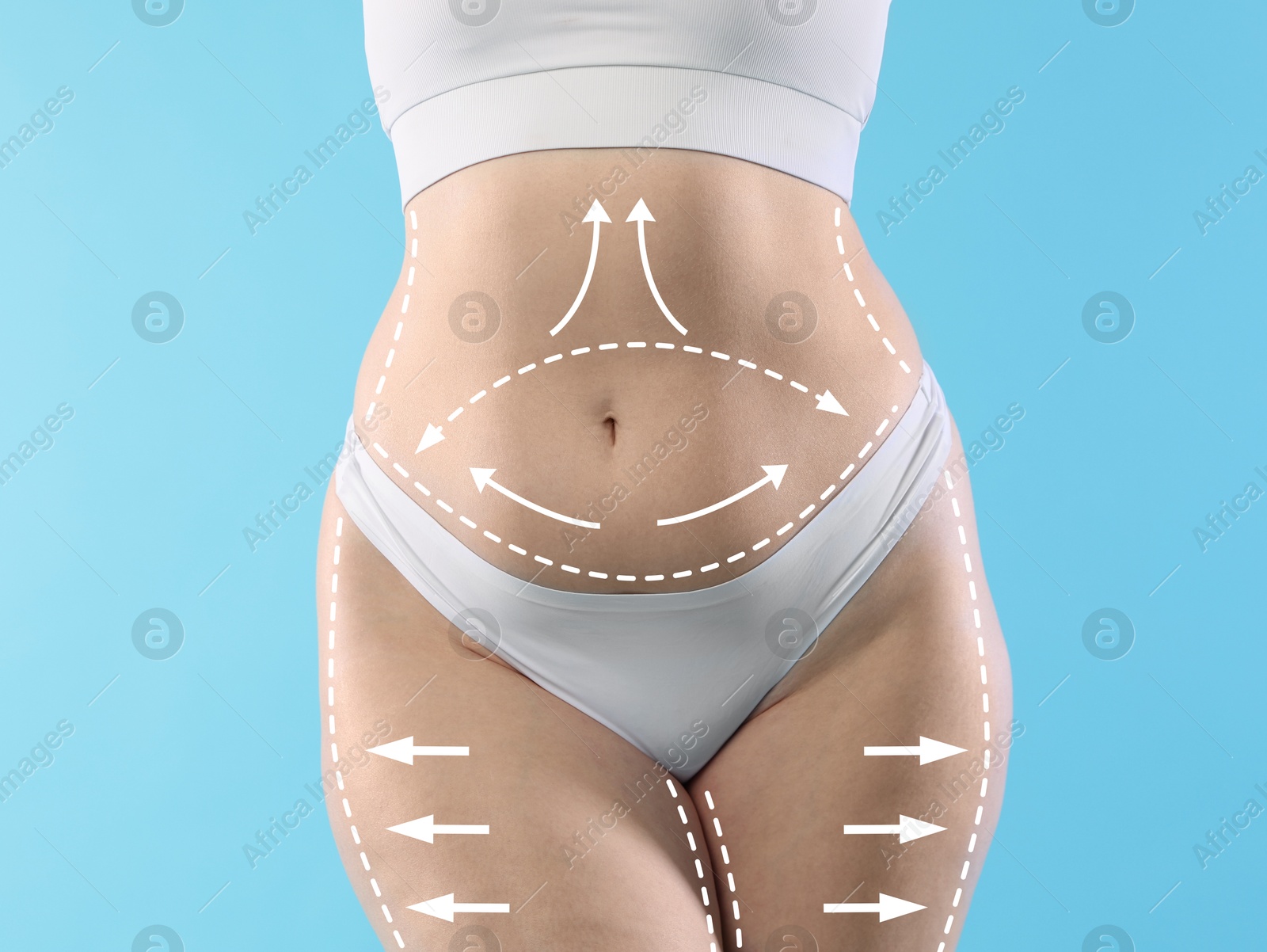 Liposuction. Woman showing her figure against light blue background, closeup. Markings on her body Image of Liposuction. Woman showing her figure against light blue background, closeup. Markings on her body