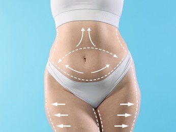Image of Liposuction. Woman showing her figure against light blue background, closeup. Markings on her body