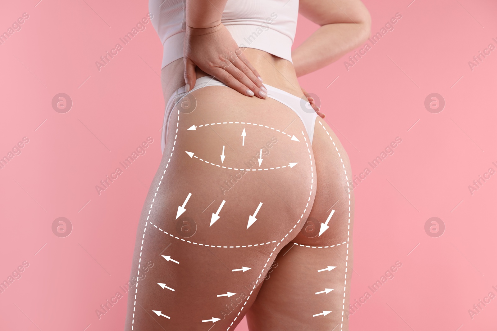 Liposuction. Woman showing her figure against pink background, closeup. Markings on her body Image of Liposuction. Woman showing her figure against pink background, closeup. Markings on her body