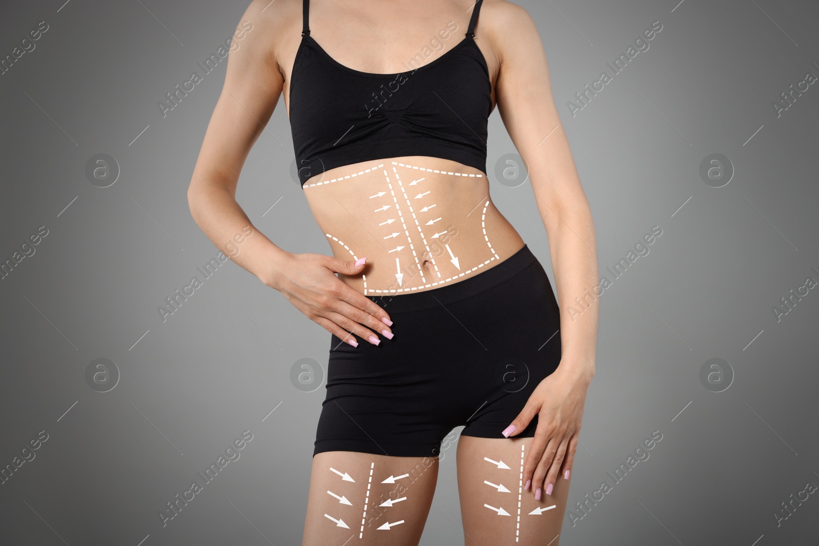 Liposuction. Woman with perfect figure against grey gradient background, closeup. Markings on her body Image of Liposuction. Woman with perfect figure against grey gradient background, closeup. Markings on her body