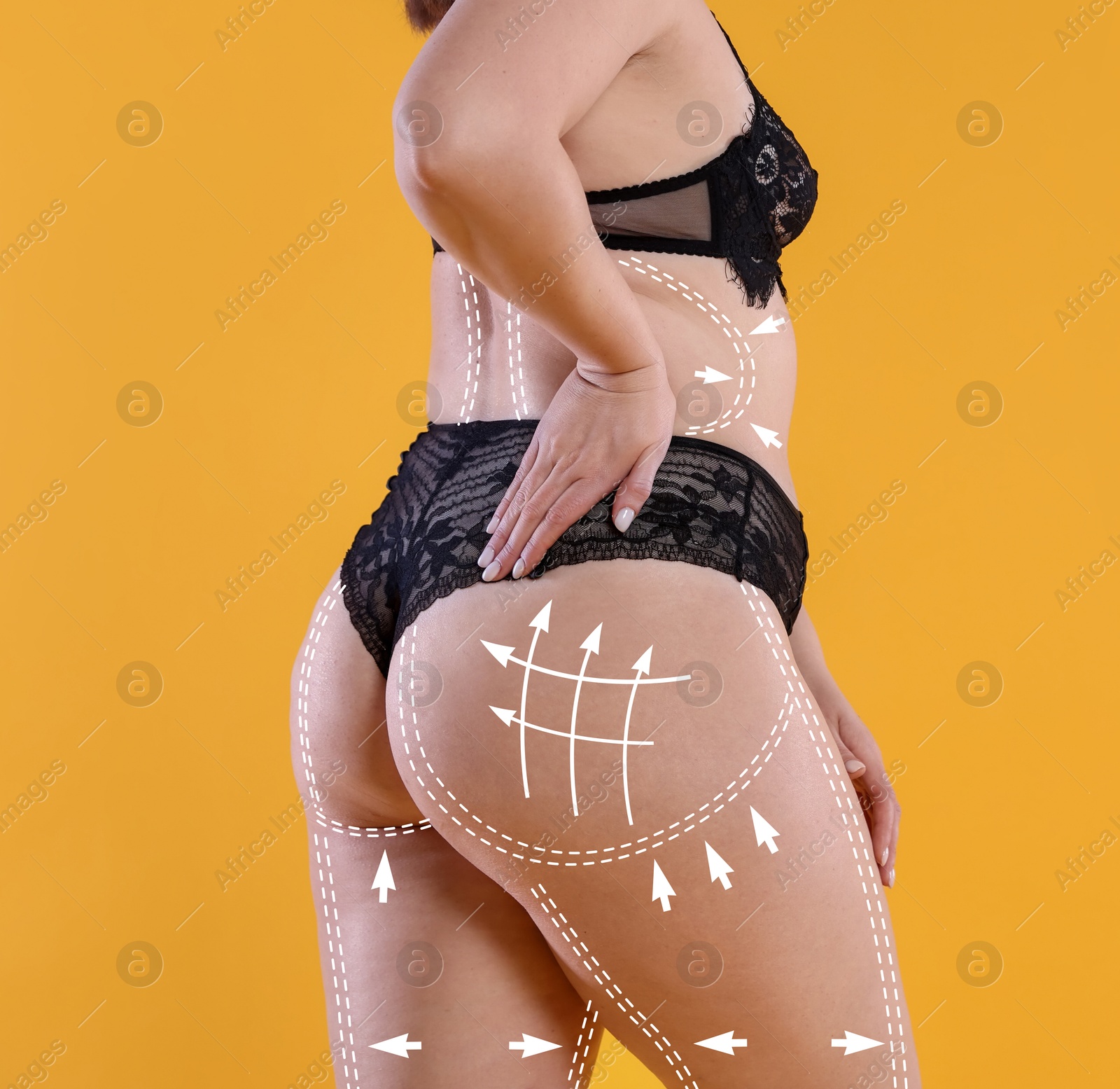 Liposuction. Woman showing her figure against orange background, closeup. Markings on her body Image of Liposuction. Woman showing her figure against orange background, closeup. Markings on her body