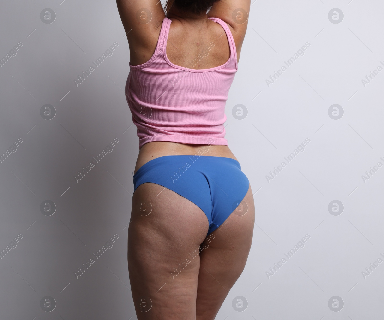 Photo of Liposuction. Woman in underwear on light grey background, back view