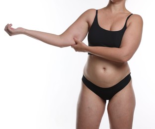 Photo of Liposuction. Woman in underwear touching her arm on white background, closeup