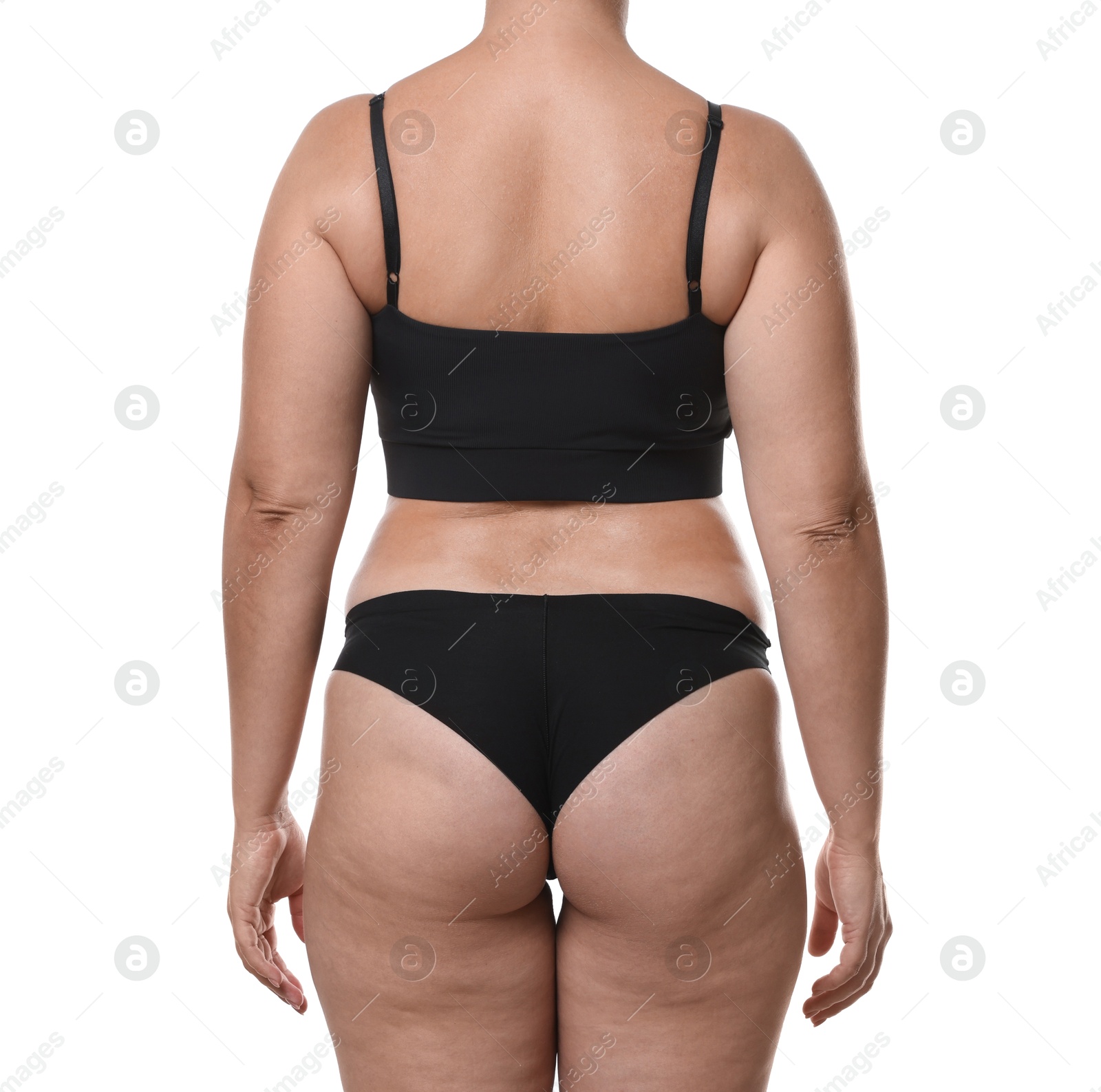 Photo of Liposuction. Woman in underwear on white background, back view