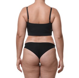 Photo of Liposuction. Woman in underwear on white background, back view