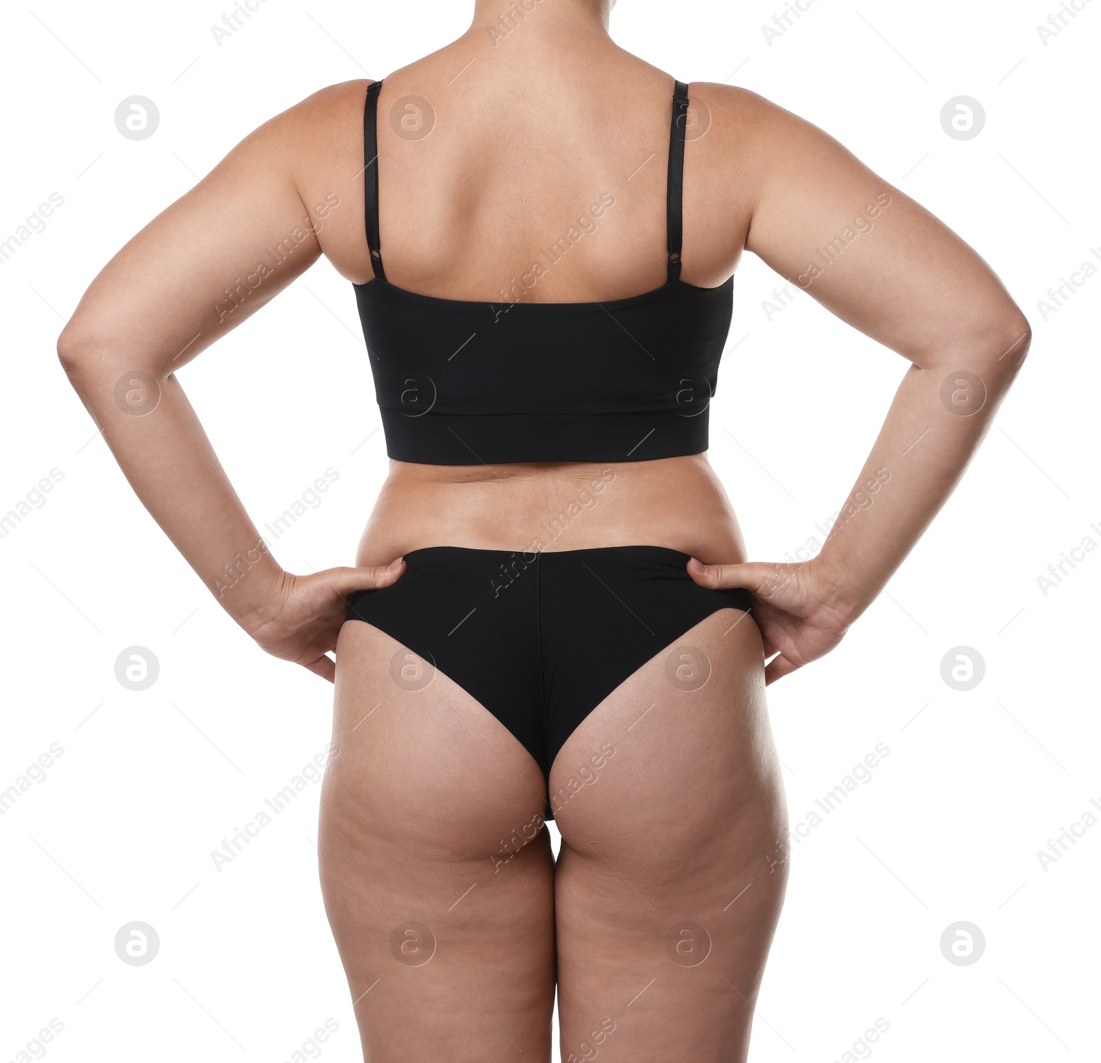 Photo of Liposuction. Woman in underwear on white background, back view