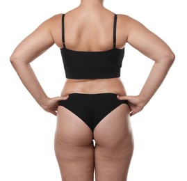 Photo of Liposuction. Woman in underwear on white background, back view