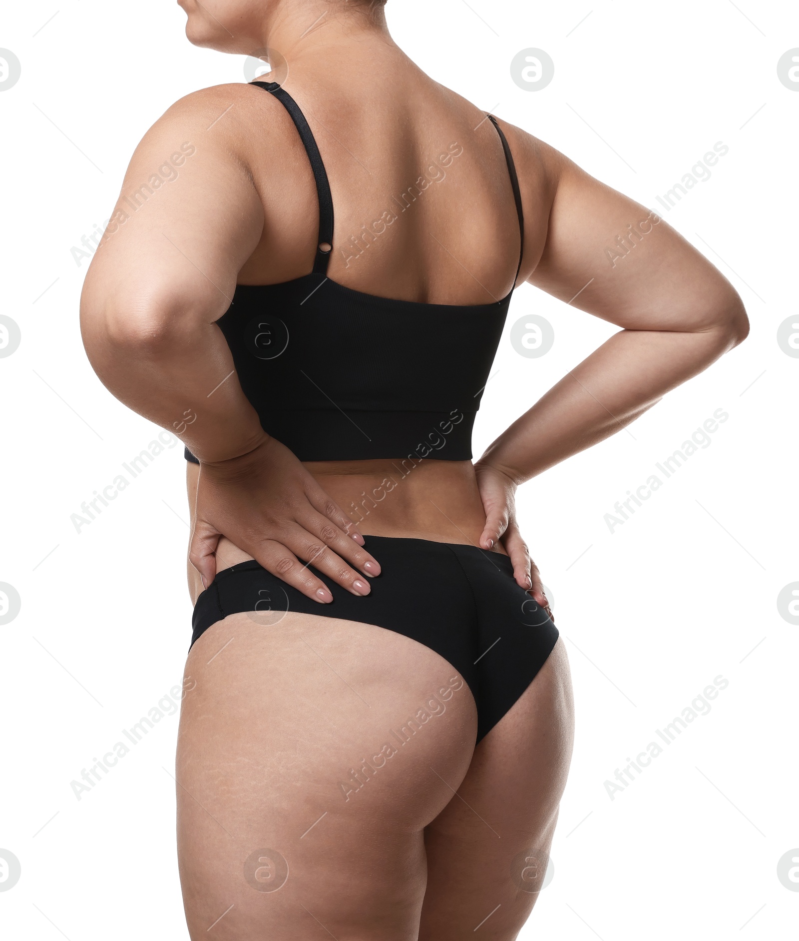 Photo of Liposuction. Woman in underwear on white background, back view