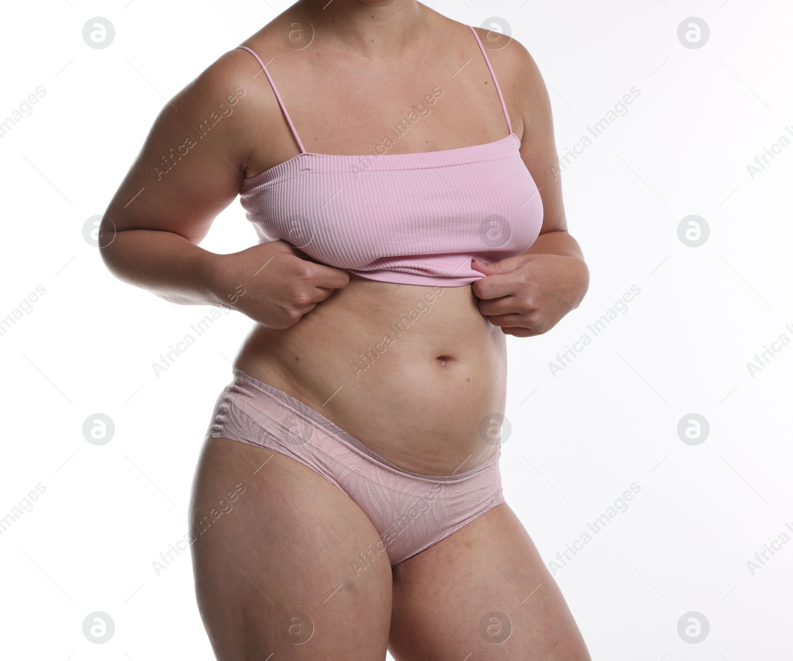 Photo of Liposuction. Woman in underwear on white background, closeup