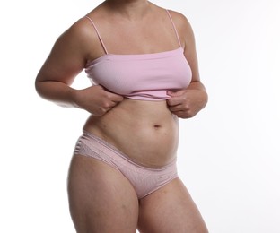 Photo of Liposuction. Woman in underwear on white background, closeup
