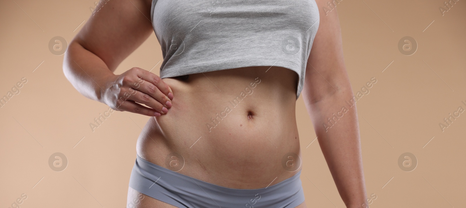 Liposuction. Woman in underwear touching her belly on beige background, closeup Photo of Liposuction. Woman in underwear touching her belly on beige background, closeup