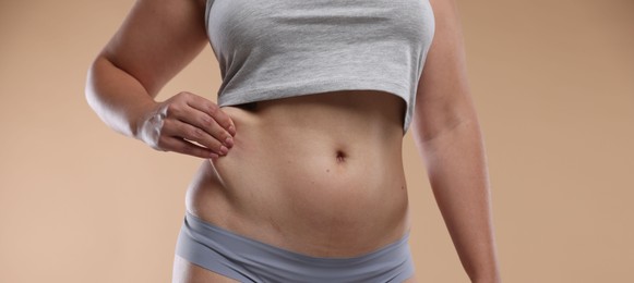 Photo of Liposuction. Woman in underwear touching her belly on beige background, closeup
