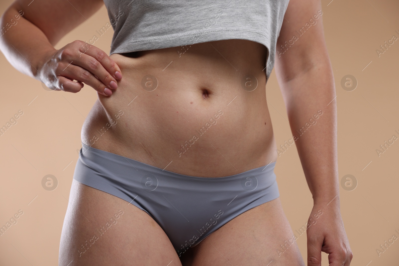 Liposuction. Woman in underwear touching her belly on beige background, closeup Photo of Liposuction. Woman in underwear touching her belly on beige background, closeup