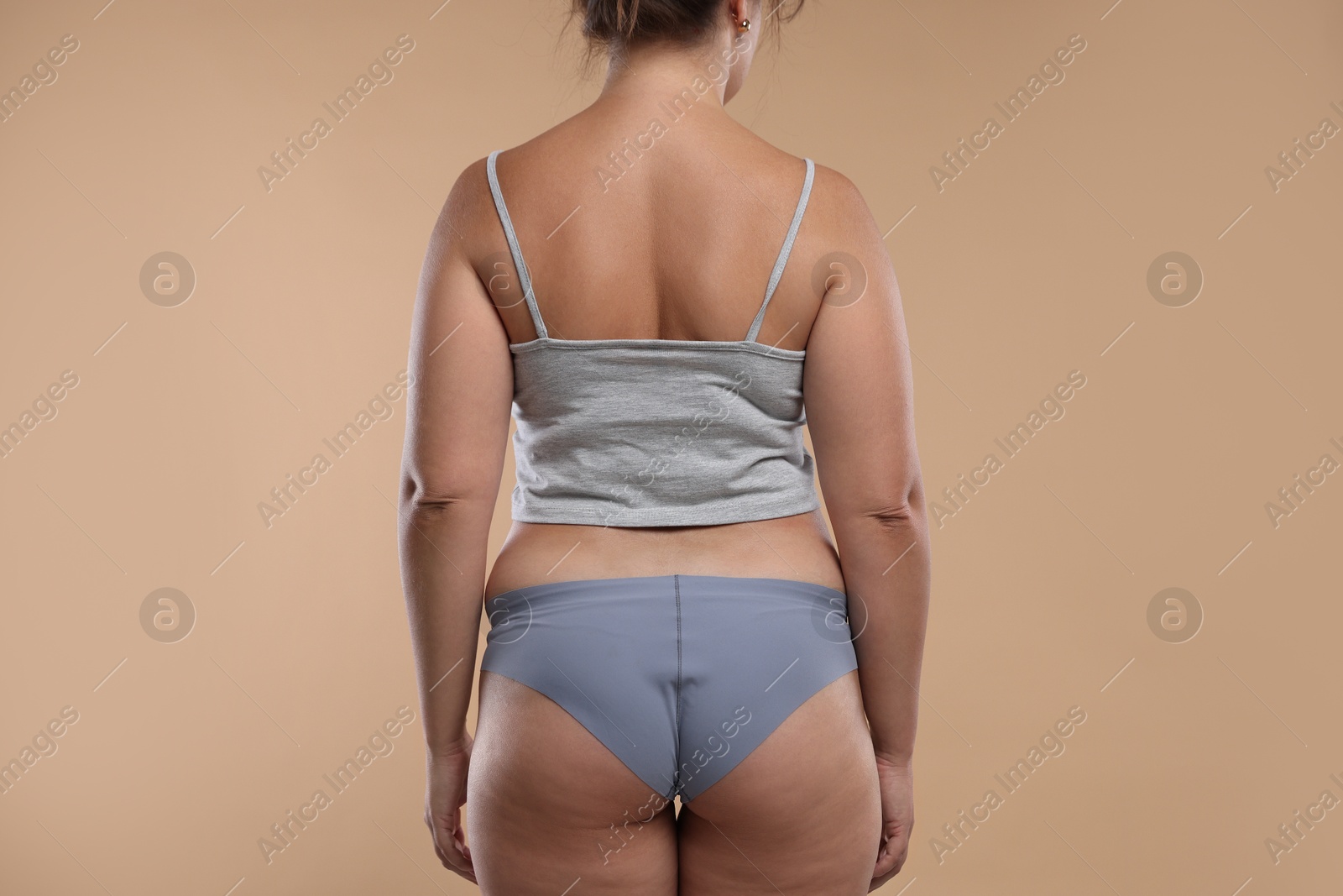 Photo of Liposuction. Woman in underwear on beige background, back view
