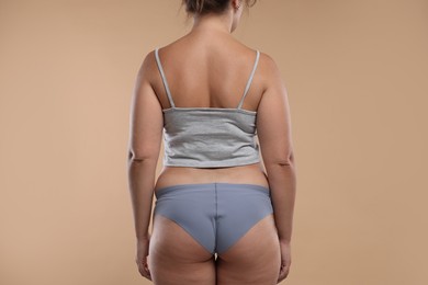 Photo of Liposuction. Woman in underwear on beige background, back view