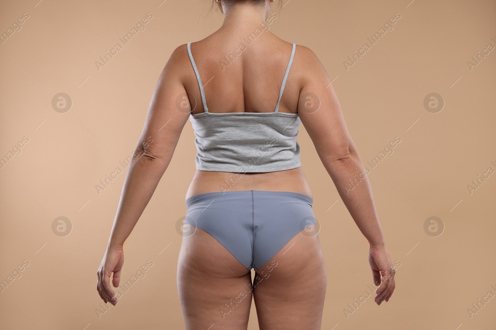 Photo of Liposuction. Woman in underwear on beige background, back view