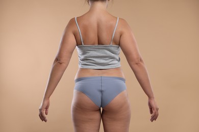 Photo of Liposuction. Woman in underwear on beige background, back view