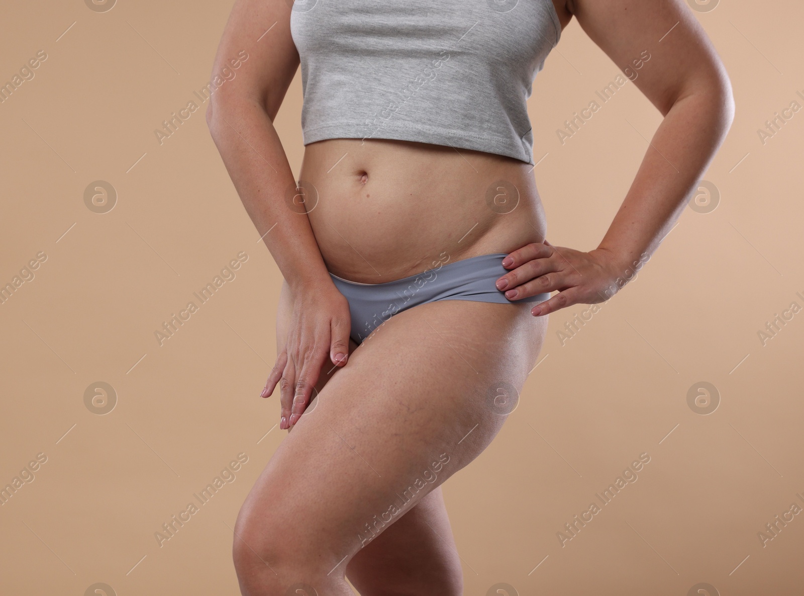 Photo of Liposuction. Woman in underwear on beige background, closeup