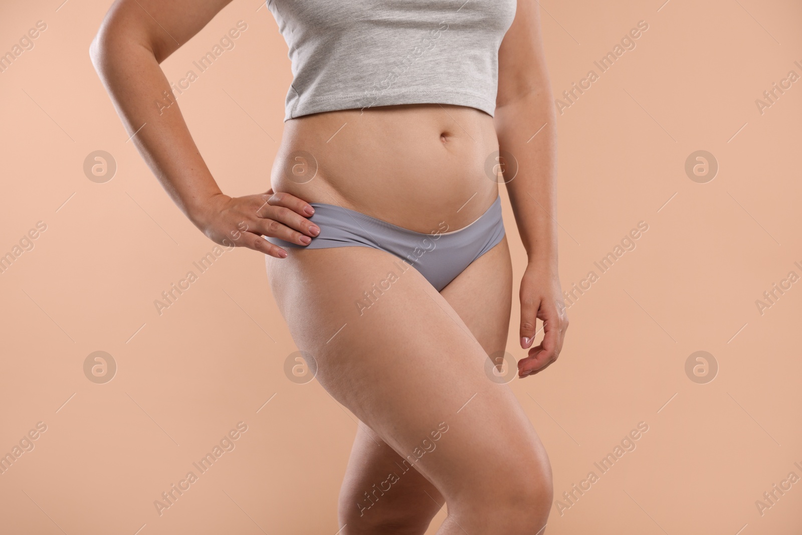Liposuction. Woman in underwear on beige background, closeup Photo of Liposuction. Woman in underwear on beige background, closeup