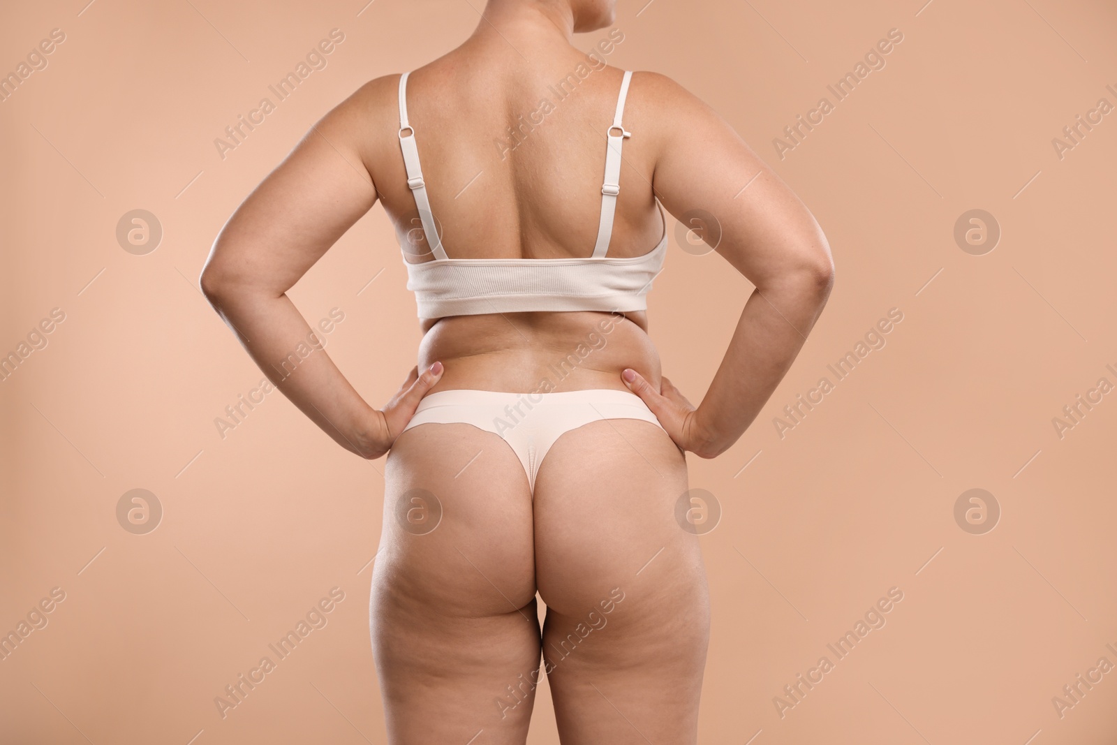 Photo of Liposuction. Woman in underwear on beige background, back view