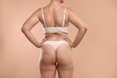 Photo of Liposuction. Woman in underwear on beige background, back view