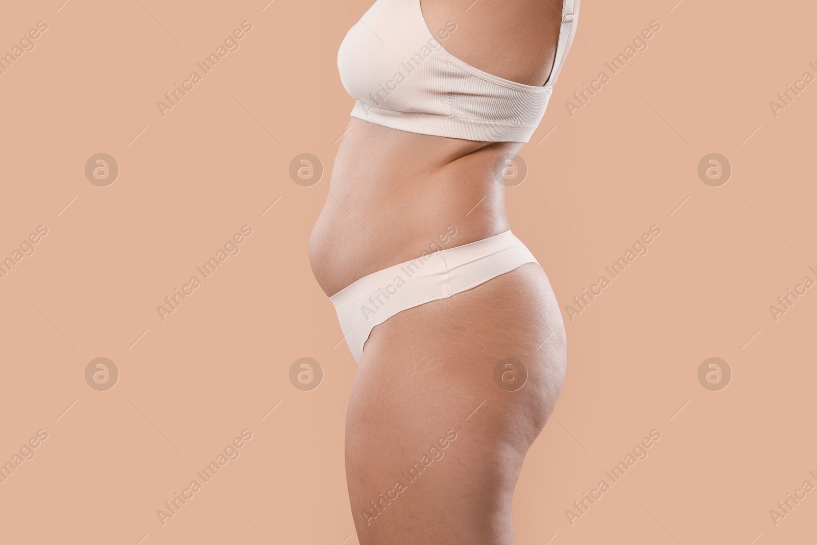 Photo of Liposuction. Woman in underwear on beige background, closeup