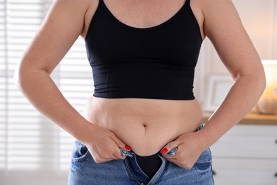 Photo of Liposuction. Woman trying to put on tight jeans at home, closeup