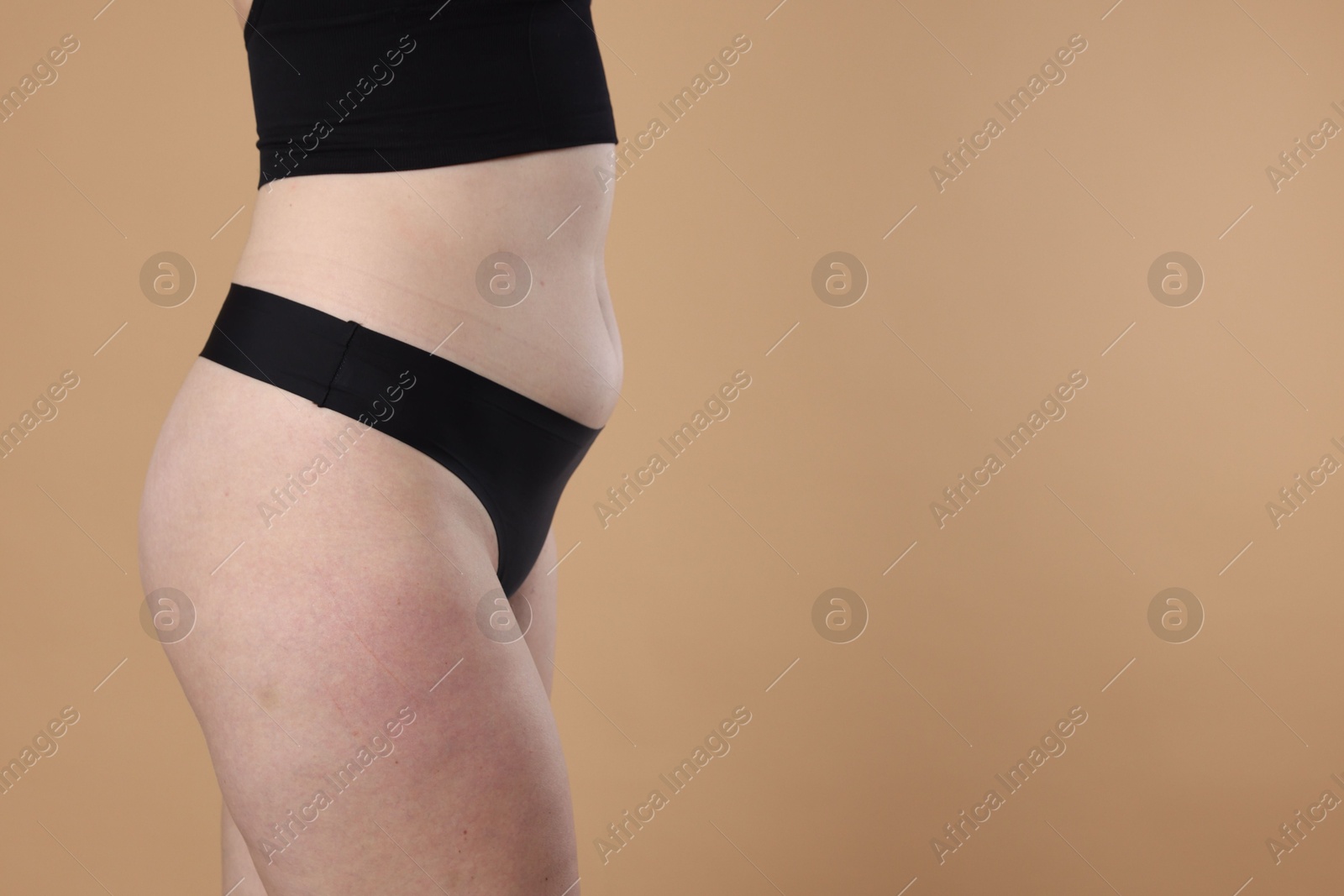 Photo of Liposuction. Woman in underwear on beige background, closeup. Space for text