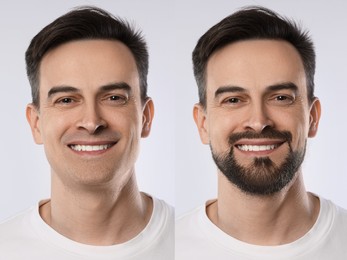 Image of Before and after collage with photos of bearded and clean-shaven man on white background