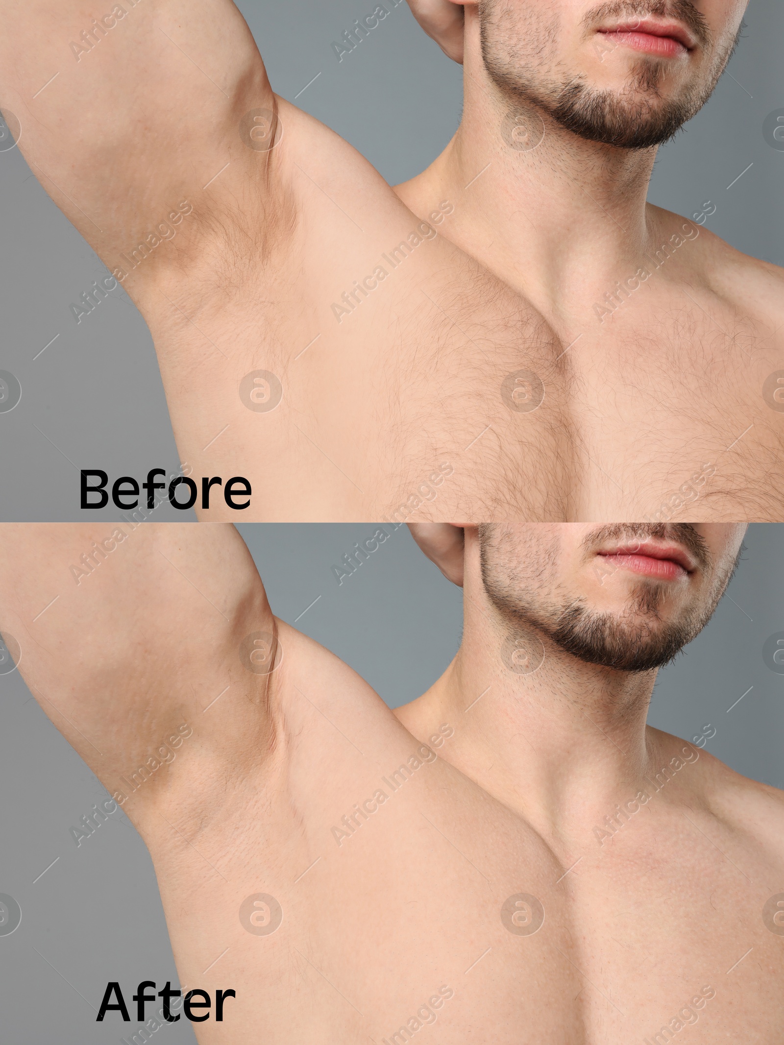 Image of Man showing his armpit and chest before and after epilation on grey background, closeup. Collage of photos
