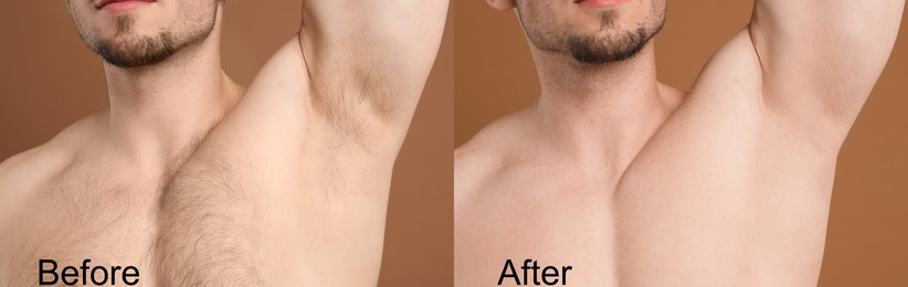 Image of Man showing his armpit and chest before and after epilation on brown background, closeup. Collage of photos