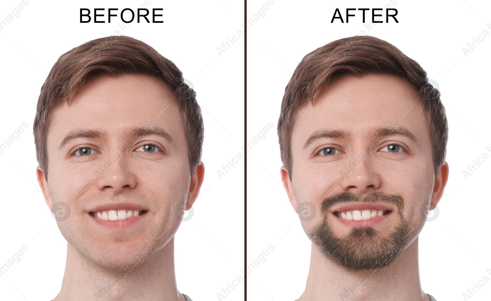 Image of Before and after collage with photos of bearded and clean-shaven man on white background