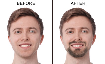 Image of Before and after collage with photos of bearded and clean-shaven man on white background