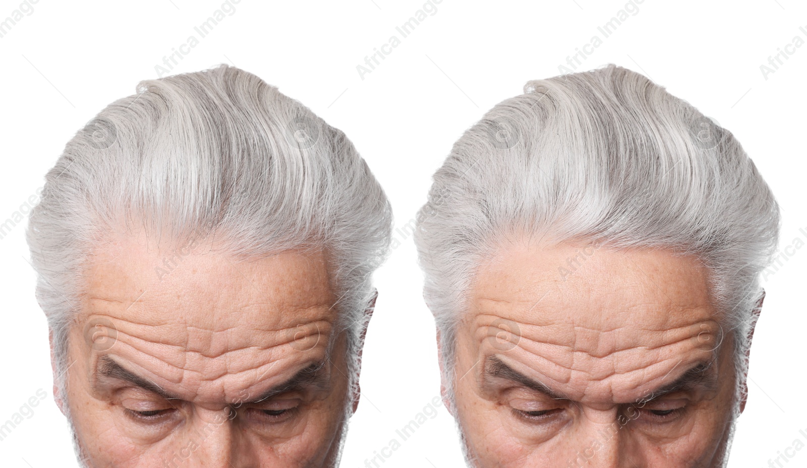 Image of Man before and after hair treatment on white background, collage