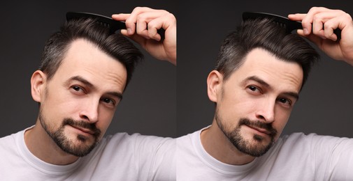 Image of Man before and after hair treatment on dark grey background, collage
