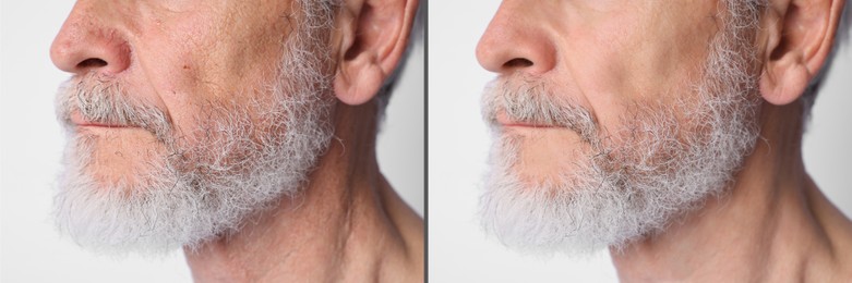 Image of Senior man showing his face before and after skin care treatment, closeup. Collage