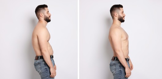 Image of Before and after collage showing man with good and bad posture against white background