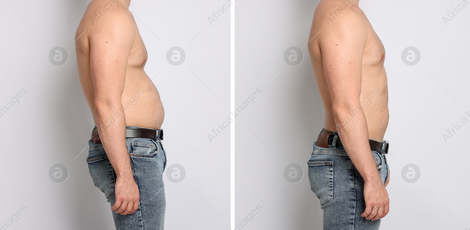 Before and after collage showing man with good and bad posture against white background, closeup Image of Before and after collage showing man with good and bad posture against white background, closeup